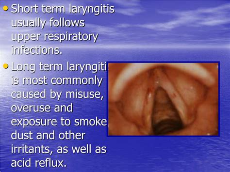 Ppt Hoarseness And Laryngitis Powerpoint Presentation Free Download