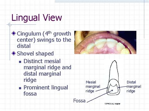Permanent Anterior Teeth Incisors Chapter 16 Central Incisor