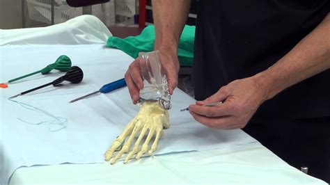Dr Moore Explains Ankle Ligament Repair And Reinforcement Using The