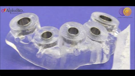 The purpose of the rehabilitation is to help correct the improper bite and enhance the overall look of the teeth. Full Mouth Guided Rehabilitation | Alpha-Bio Tec - YouTube