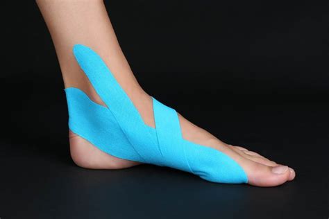 A Complete Guide On Plantar Fasciitis Taping Methods