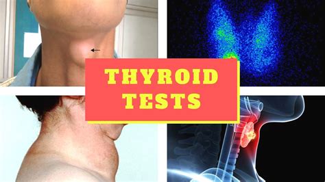 Thyroid Function Tests Tfts Blood Tests To Diagnose Thyroid