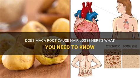 Does Maca Root Cause Hair Loss Here S What You Need To Know ShunHair