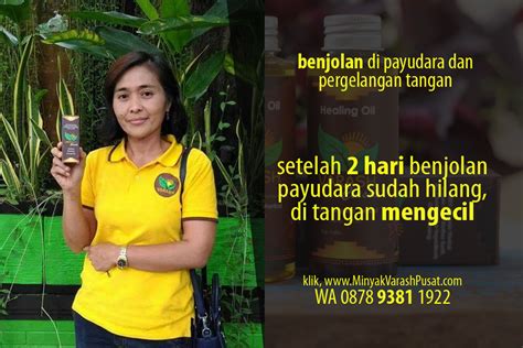 Benjolan biasanya dapat dirasakan saat ada satu area spesifik pada payudara yang membengkak dan menonjol. TIDAK NGILU LAGI, Benjolan di Payudara dan Pergelangan ...