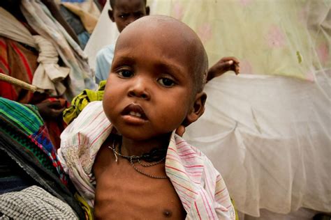 Children Starving In Drought Hit Somalia Abc News Australian