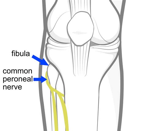 Peroneal Nerve Injury Treatment Causes Symptoms