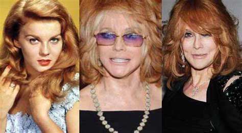 Right after wwii, at the age of six, she moved with her family and they settled near chicago, illinois, usa, and in the early years started taking dancing classes. Ann Margret Plastic Surgery Before and After Pictures 2021