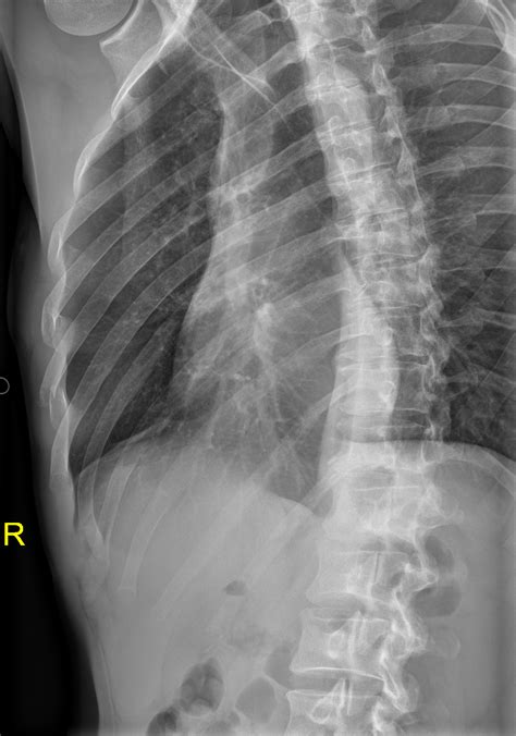 Image | Radiopaedia.org