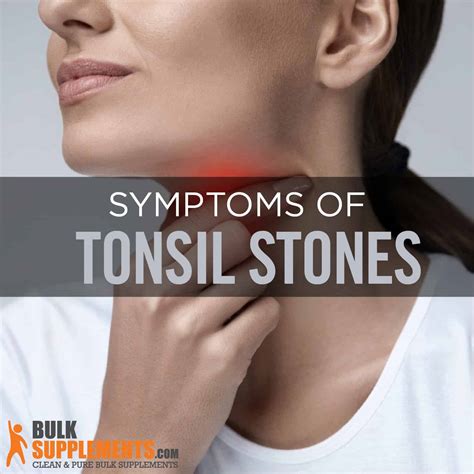 Tonsil Stones Tonsilloliths What Are They And How To Get Rid Of Them