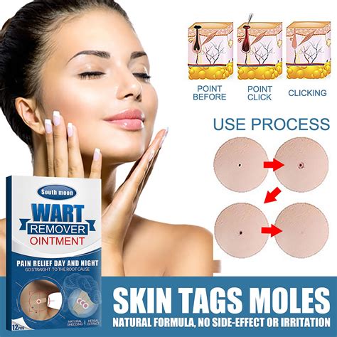 wart removal sticker skin mole cleaning care corns thorn wart meat grain wart corn removers for