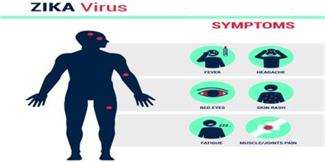 In this article, we will review all this is because zika often causes no symptoms and can be mistaken for other diseases. Zika Virus (ZIKV) - Assignment Point