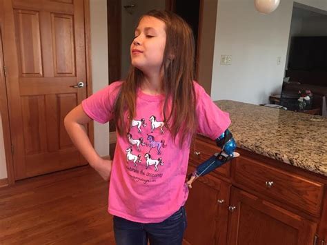 this girl born without a full arm created a prosthetic that shoots sparkles