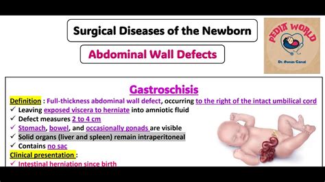 Surgical Neonatology Gastroschisis Omphalocele Hernia And Hydrocele