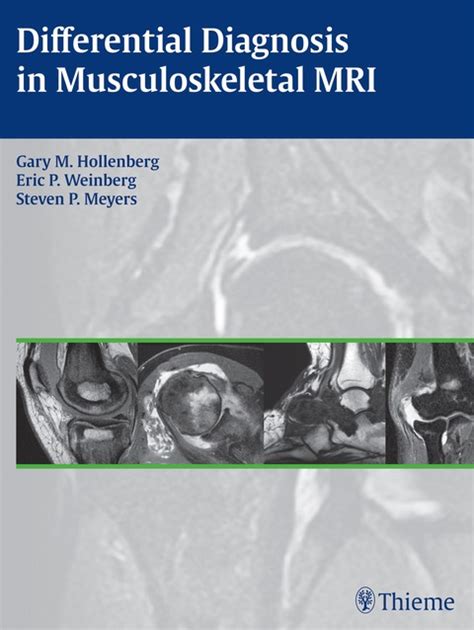 Differential Diagnosis In Musculoskeletal Mrihollenberg Gm Weinberg E