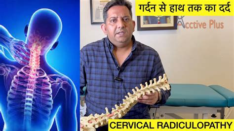 Cervical Radiculopathy गर्दन से हाथ तक का दर्द Hindi Youtube