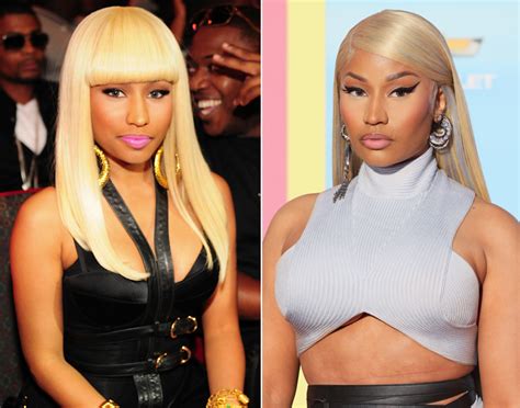 Nicki Minaj Says She Regrets Getting Plastic Surgery