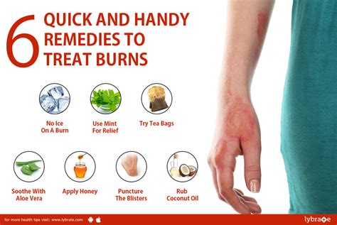 6 Quick And Handy Remedies To Treat Burns By Dr Aman Sharma Lybrate