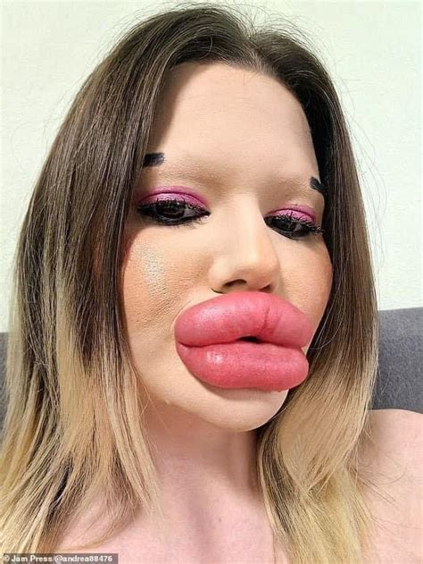 𝗔𝗻𝗱𝗿𝗲𝗮 𝗜𝘃𝗮𝗻𝗼𝘃𝗮 Holds The Guinness World Record For The Largest Lips