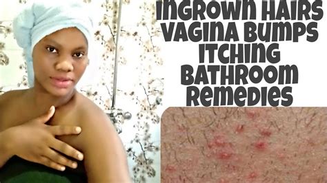 how to stop ingrown hairs itching and vagin l bumps from shaving and waxing shaving tips for