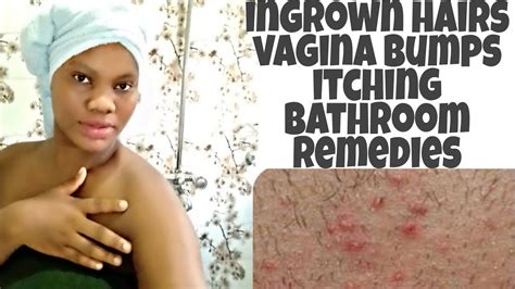 Tilt the razor and lightly. How to stop ingrown hairs, itching & vagin@l bumps from ...