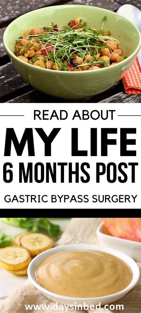 My Bypass Surgery Diet Successful Results At 24 Weeks Gastric Bypass