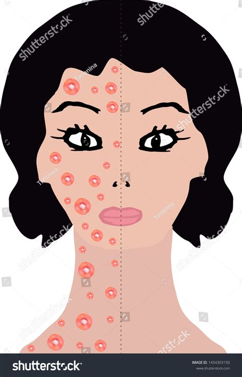 Allergy Trigger Skin Rash On Half Of Face