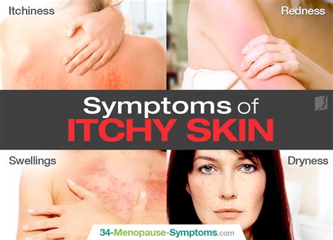 Symptoms Of Itchy Skin Menopause Now