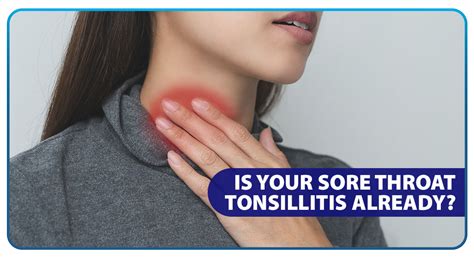 Is Your Sore Throat Tonsillitis Already Unilab