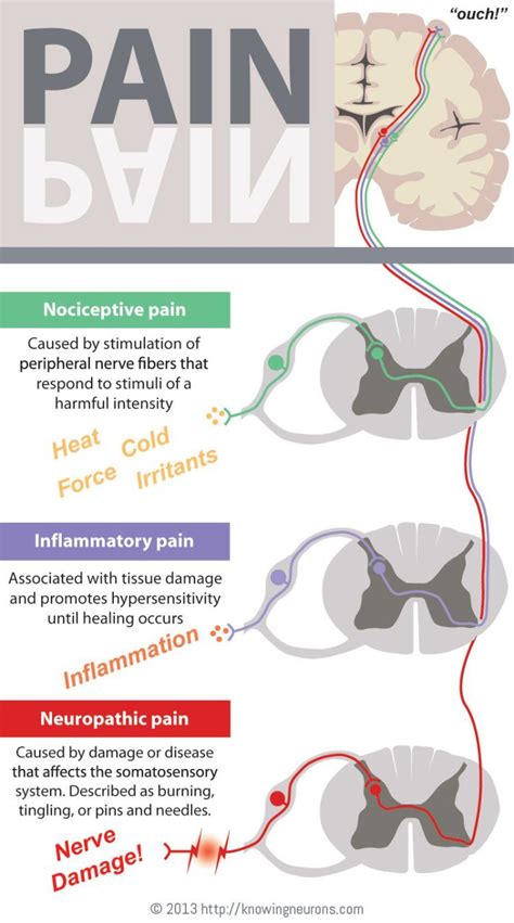 Pain Infographic Knowing Neurons Nociceptive Inflammatory Neuropathic