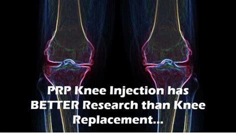 should you get prp knee injection