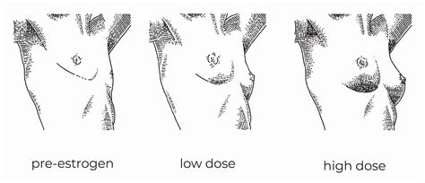 estrogen hrt and breast growth