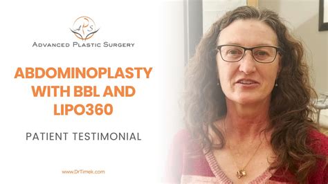 Patient Testimonial Abdominoplasty With Lipo360 And Bbl Youtube