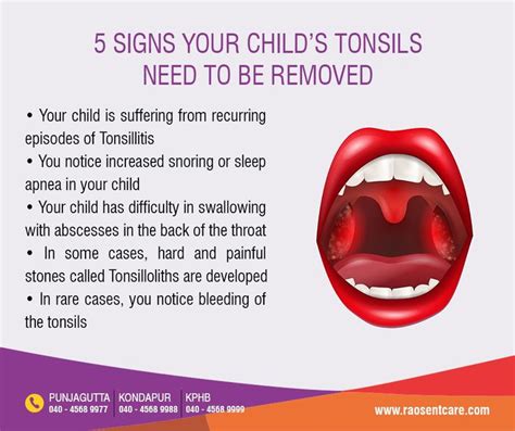 5 Signs Your Childs Tonsils Need To Be Removed