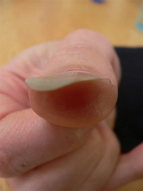 What Does It Mean When Your Fingernails Curve Down Bios Pics