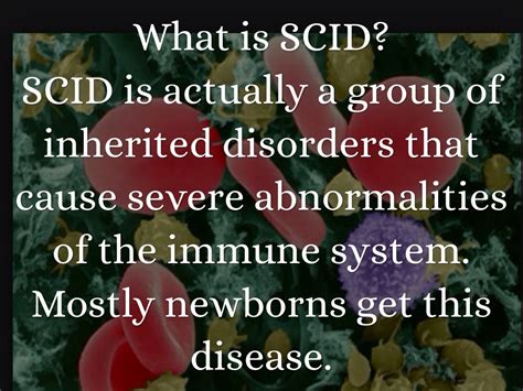Severe Combined Immunodeficiency Scid By Tori Armenta