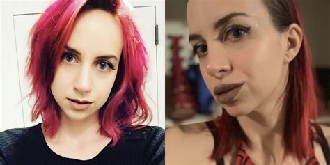 Can Getting Lip Fillers Affect Your Sex Life Self