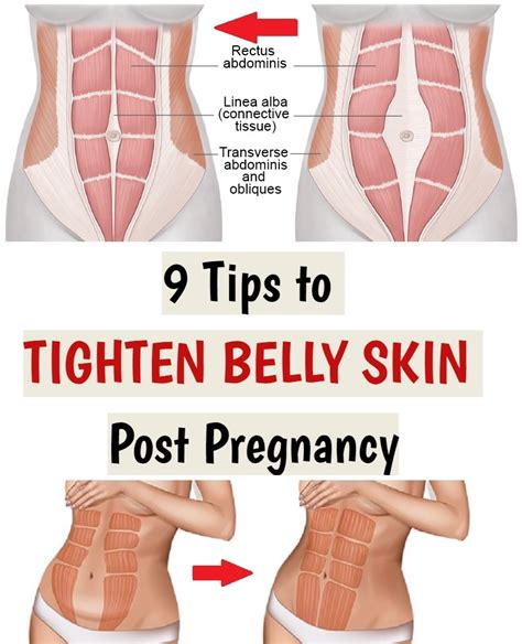 Tips To Tighten Belly Skin Post Pregnancy Good Life