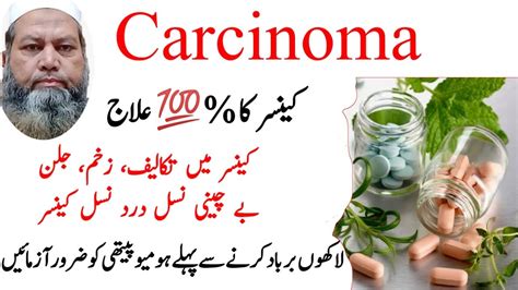 Homeopathic Cure For Cancer L Cancer Treatment By Homeopath Muhammad Shafique Youtube