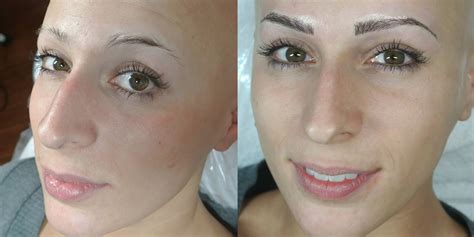 Alopecia Sheila Bella Permanent Makeup And Microblading