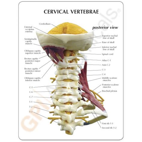 See more ideas about back pain, spine health, spine problems. Cervical Spine Model with Muscles 1720 | Neck Muscles ...