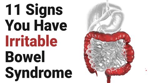 Signs You Have Irritable Bowel Syndrome Irritable Bowel Syndrome Irritable Bowel