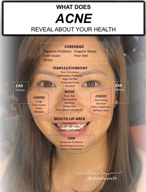 Facial Skin Care Routine Face Skin Care Healthy Skin Tips Healthy