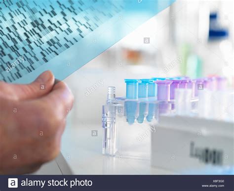 Sequencing Gel High Resolution Stock Photography And Images Alamy