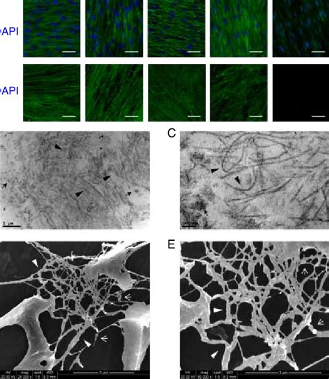 Characterization Of Decellularized Extracellular Matrix Ecm A