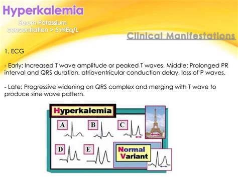 Hypokalemia And Hyperkalemia Ppt 2