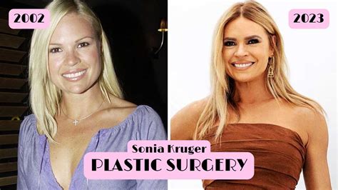 Exclusive Details On Sonia Kruger S Plastic Surgery Botox More