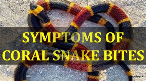 Coral Snake Bite Treatment Unique And Different Wedding Ideas