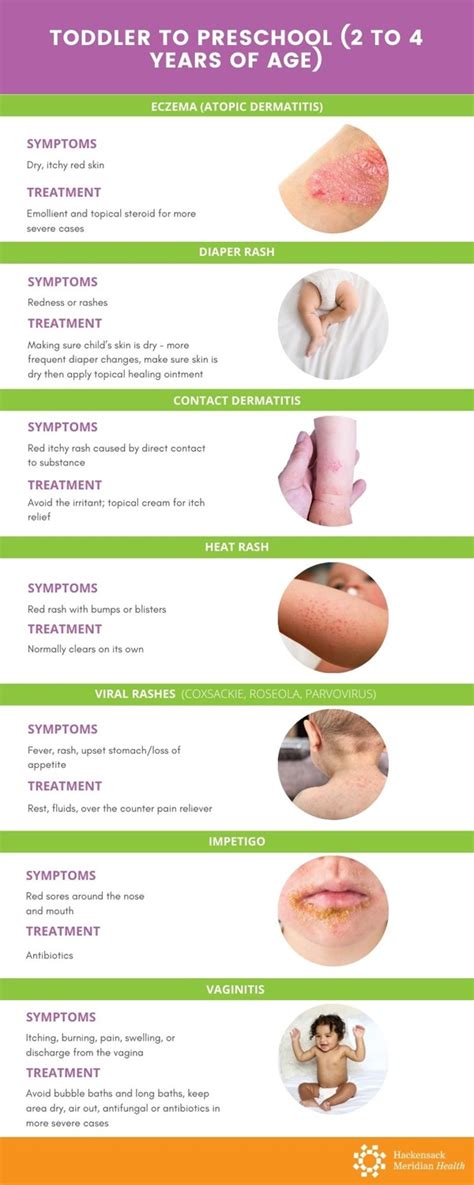 A Handy Guide To Common Childhood Viral Skin Conditions Images And