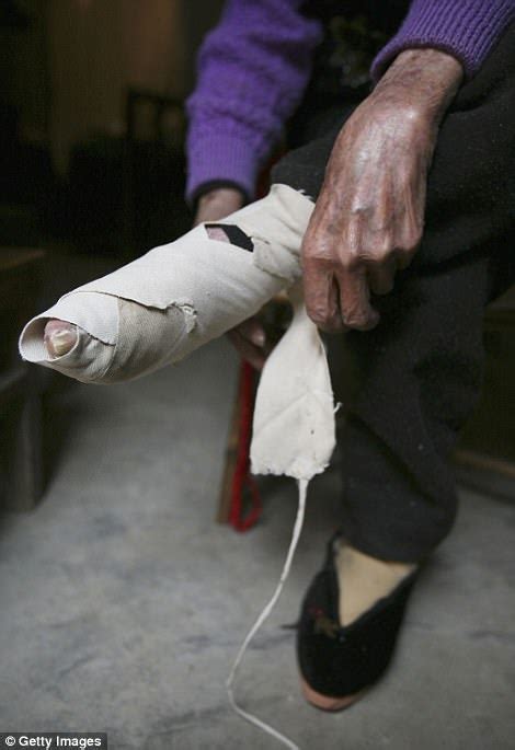 Shocking Pictures Of Chinas Bound Feet Women Village Daily Mail Online