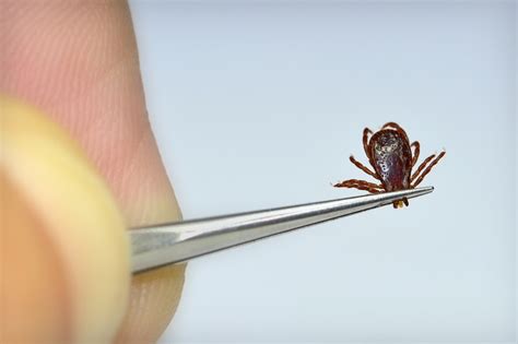 Try This Amazing Tick Removal Tool When A Tick Wont Come Off Die